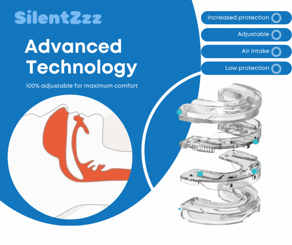 SilentZzz – Anti-Snoring